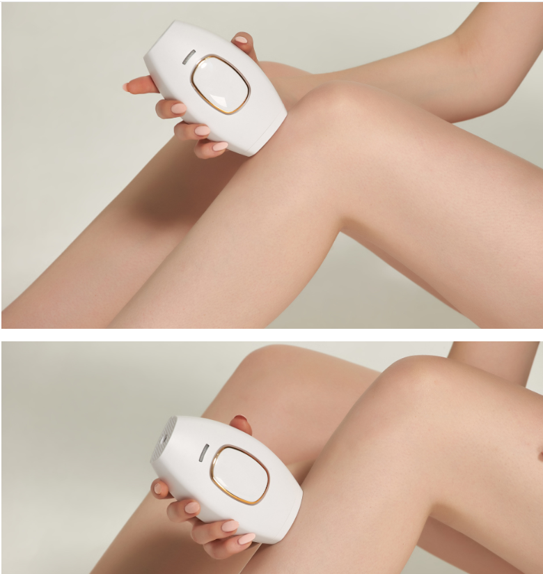 Glowvera™ IPL Pro
